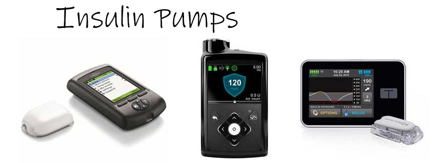 Insulin Pump: What It Is, How It Works & Types